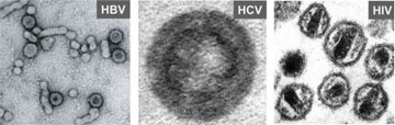 Abb. 1: Elektronenmikroskopische Aufnahmen von HBV, HCV und HIV-1 Partikeln (freundlicherweise zur Verf�gung gestellt von Prof. S. Urban und S. Seitz (HBV), A. Merz (HCV) und Prof. H.-G. Kr�usslich (HIV)) 