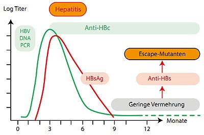 Abbildung 2: Entstehung einer okkulten HBV-Infektion mit Escape-Mutanten nach einer ausgeheilten akuten  Hepatitis B.
