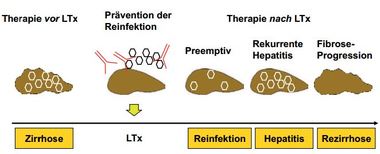 Abbildung 1:Strategien und Zeitpunkte für den Beginn einer antiviralen Therapie.