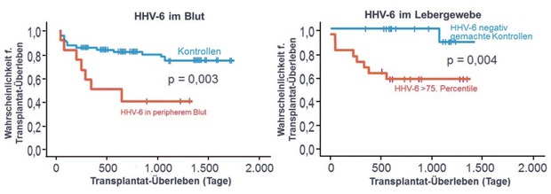 Abb. 1   Nachweis von HHV6 DNA im Gewebe in höheren Konzentrationen oder im Blut  korrespondiert mit schlechterem Überleben nach Lebertransplantation (modifiziert nach 6 )