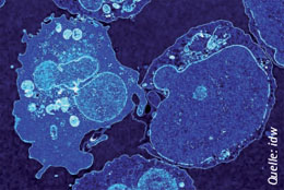 Abb. 2: T-Zellen (blau angefrbt).